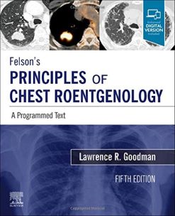 Felson’s Principles of Chest Roentgenology, A Programmed Text: A Programmed Text (PDF+Videos)