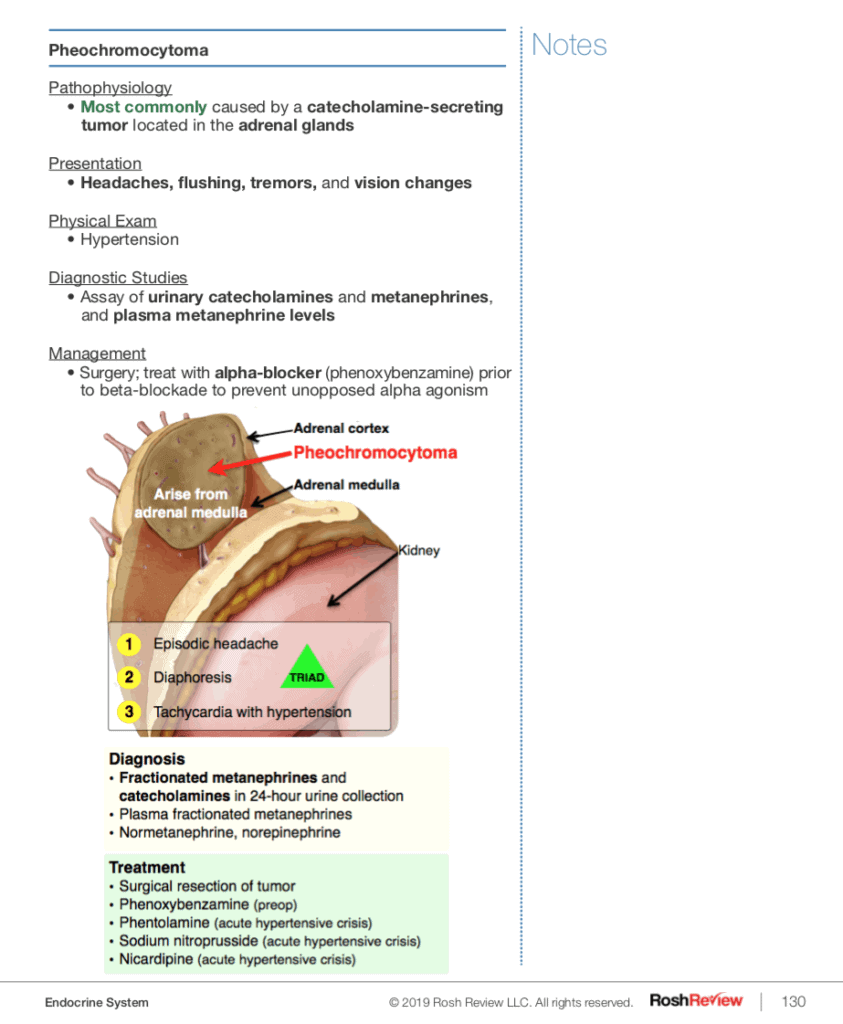 Pheochromocytoma Teaching Image